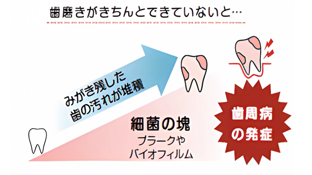 口腔ケアの怠り